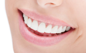 woman smiling perfect teeth