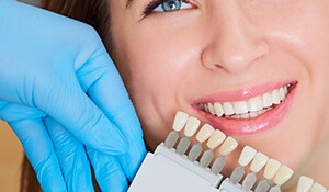 Woman smiling with tooth shade chart