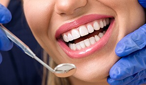 Beautiful smile examined following porcelain veneers