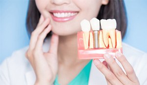 a person holding a model of a dental implant