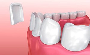 cosmetic dentistry